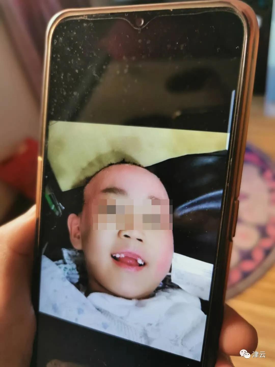 最新傷情鑒定規(guī)范解析與應用指南