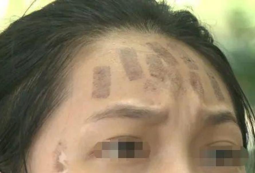 成都光子嫩膚價格，科技重塑肌膚之美