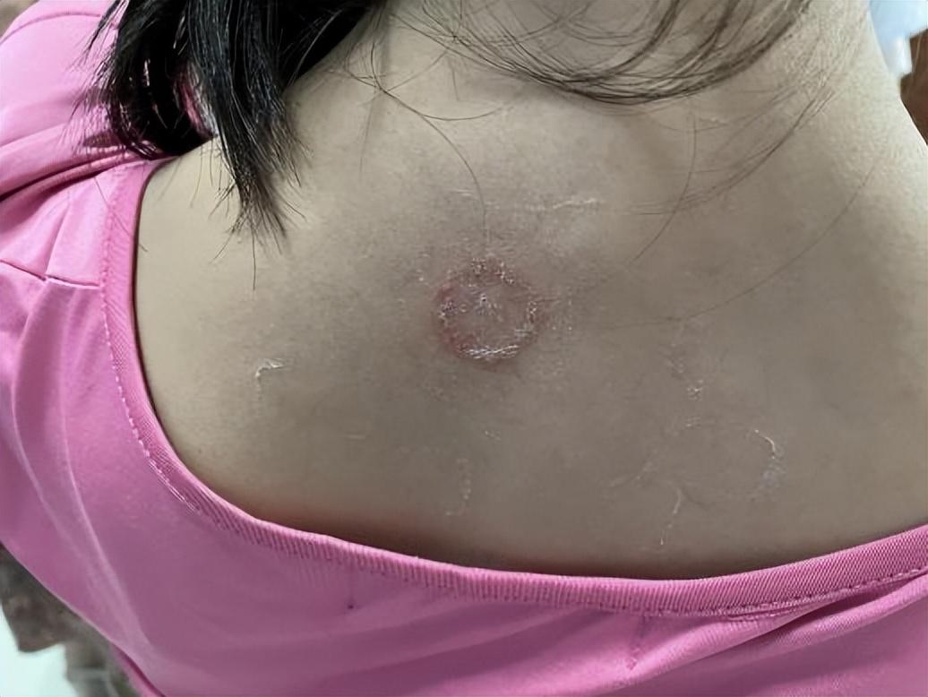 尤卓爾軟膏價格大解密，重磅揭秘真實(shí)價格??