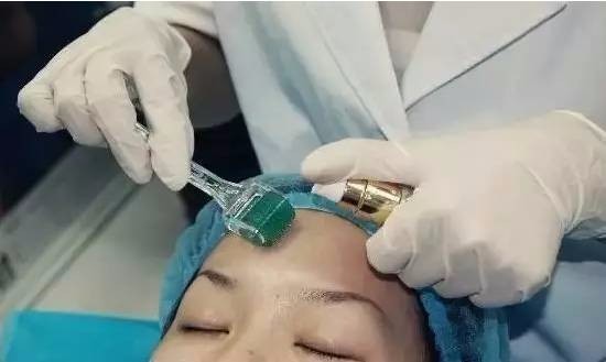 果酸換膚成本與代價(jià)揭秘，美麗背后的價(jià)格標(biāo)簽