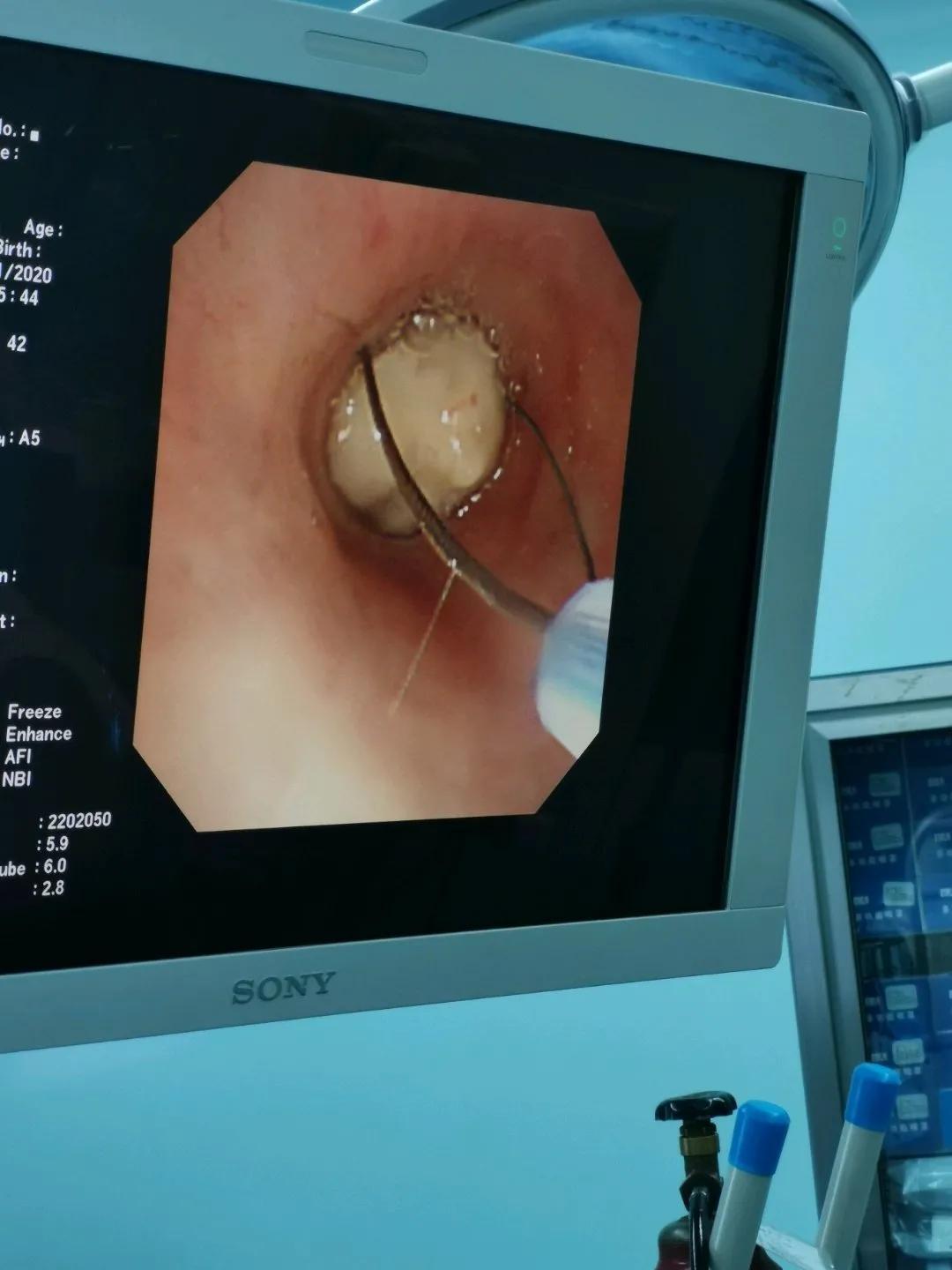 電子鼻咽喉鏡價格的市場定位分析，多元因素下的市場趨勢探討