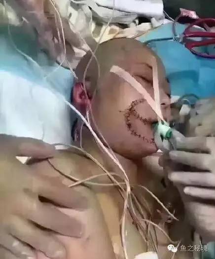 被虎咬的女子的最新消息，日常中的奇遇時刻